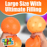 Giant Satisfying and Fun Jumbo Squishy Stress Ball for Kids and Adults with Therapy and Sensory Needs (Bumpy Texture) CASE OF 16